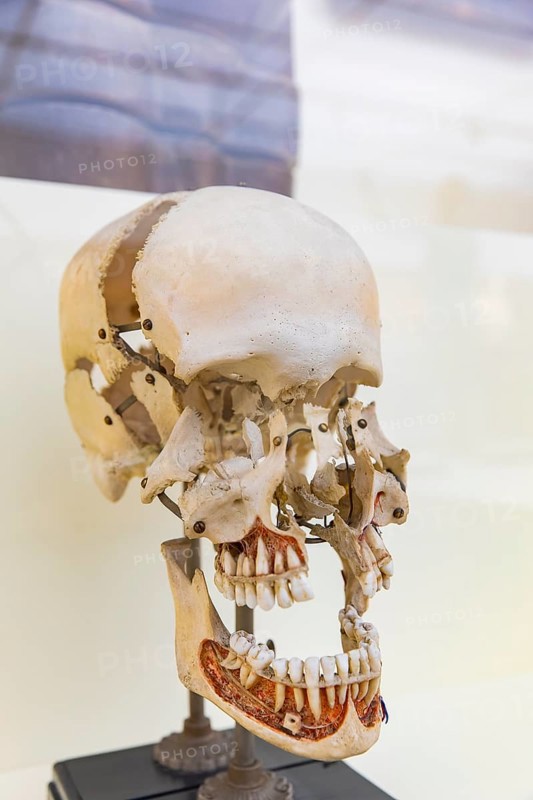 Founded in 1912, the Deutsches Hygiene-Museum is a museum in Dresden. It sees itself as a public forum for science, culture and society. Blown up skull around 1920
