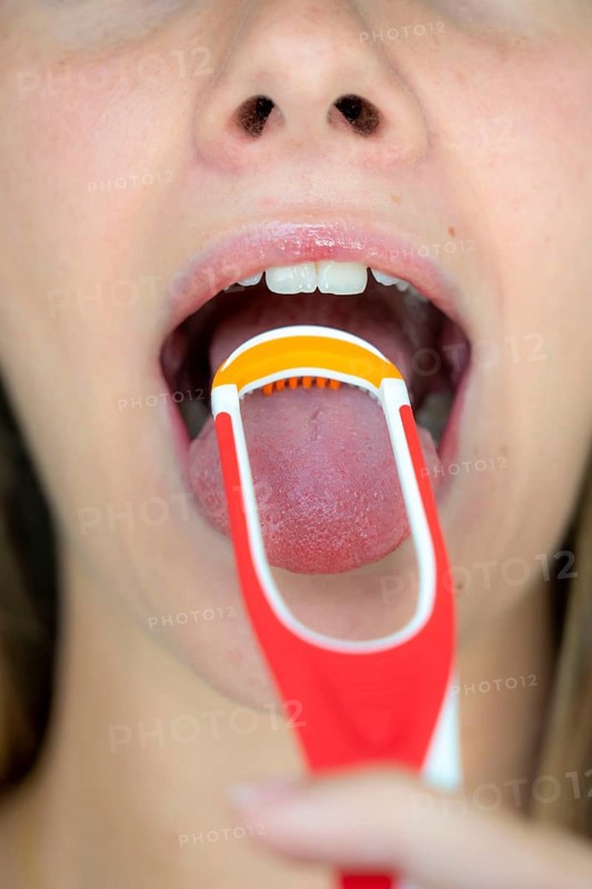 Bad breath, prevention by cleaning the tongue with a tongue brush