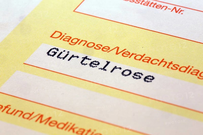Symbolic image: Shingles diagnosis on a doctor's referral. Shingles often occurs after coronavirus infections, but is also one of the side effects of a coronavirus vaccination
