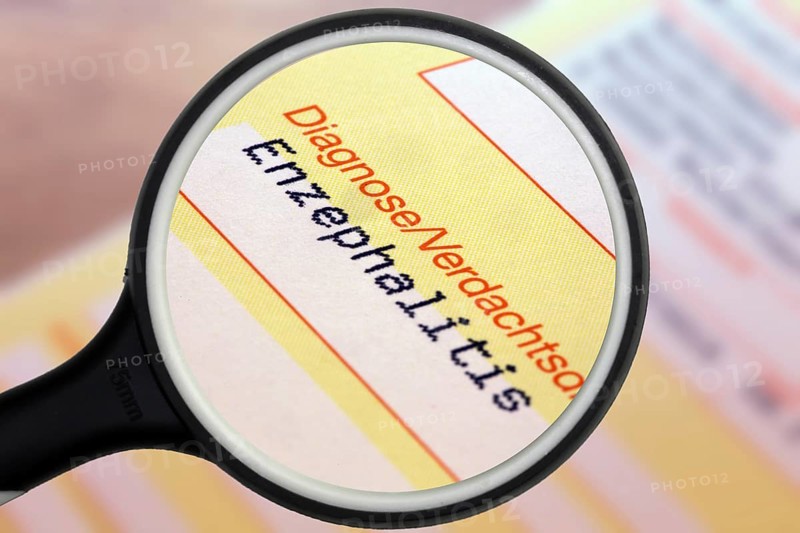 Symbolic image: Diagnosis of encephalitis on a doctor's referral. Encephalitis often occurs after corona infections, but is also one of the side effects of a corona vaccination