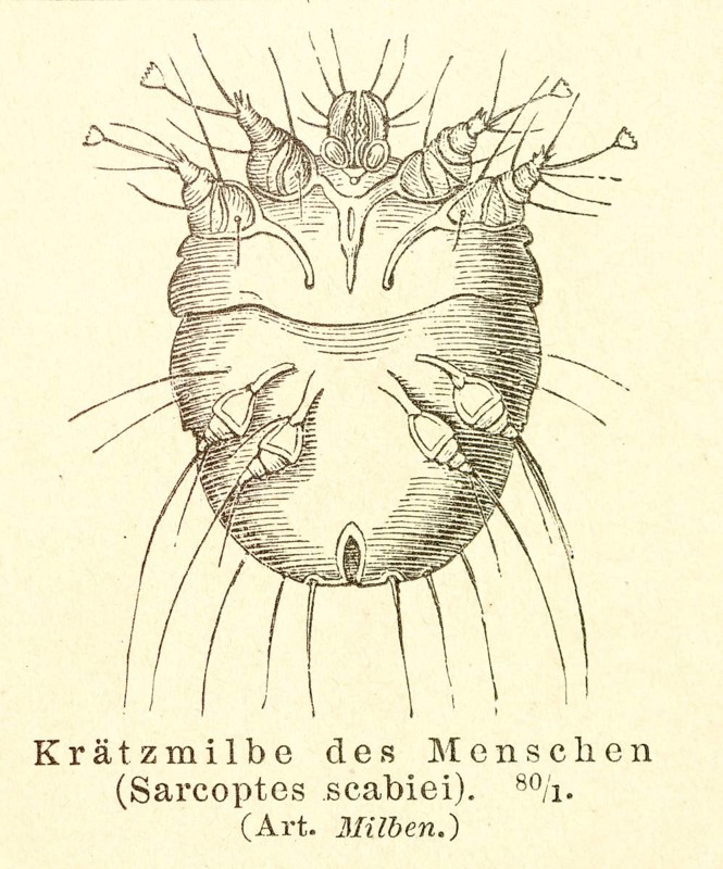 Historical wood engraving, illustration from Meyers encyclopedia 4th edition 1889 and 1890, scabies mite (Sarcoptes scabiei) or grave mite or scabies mite, mites, parasite, trigger of the disease scabies or scabies, scabies or acarodermatitis, detailed illustration in black and white on old paper, Germany, Europe
