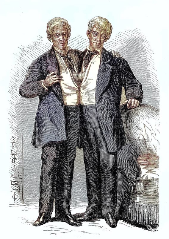 Chang and Eng Bunker, 11 May 1811, 17 January 1874, were conjoined twins who gave their name to this deformity, Historical, digitally restored reproduction of a 19th century original