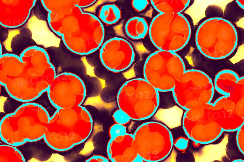 Shape of bacterial cell: cocci, bacilli, spirilla bacteria background
