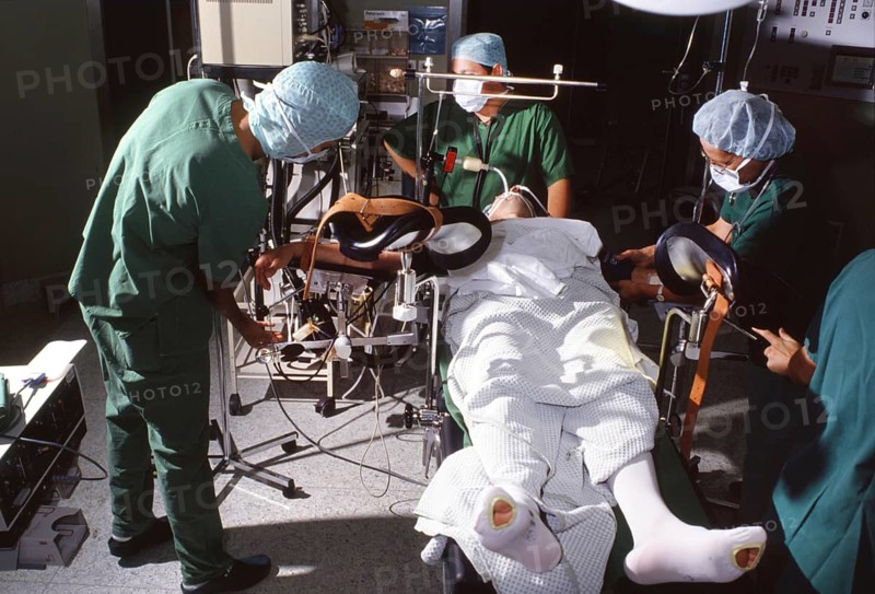 DEU, Germany: The historical slides from the times 80-90s events and persons from politics, culture, working life, medicine a.o. Ruhr area. Accident victims. Medicine.surgery