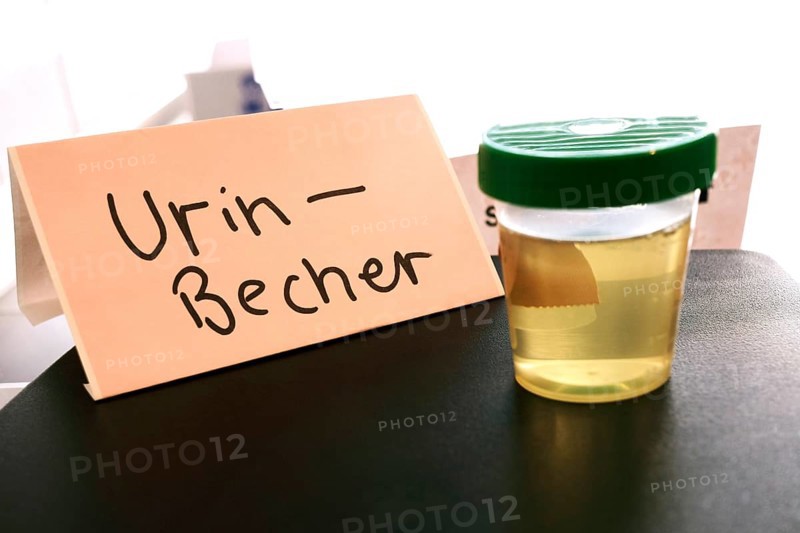 A cup with urine, urine sample, urine cup, doctor's surgery, examination, health