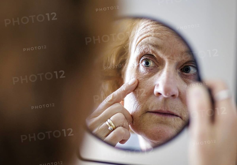 Symbolic photo on the subject of eye wrinkles. A woman looks at her eye wrinkles in the mirror. Berlin, 13.08.2024