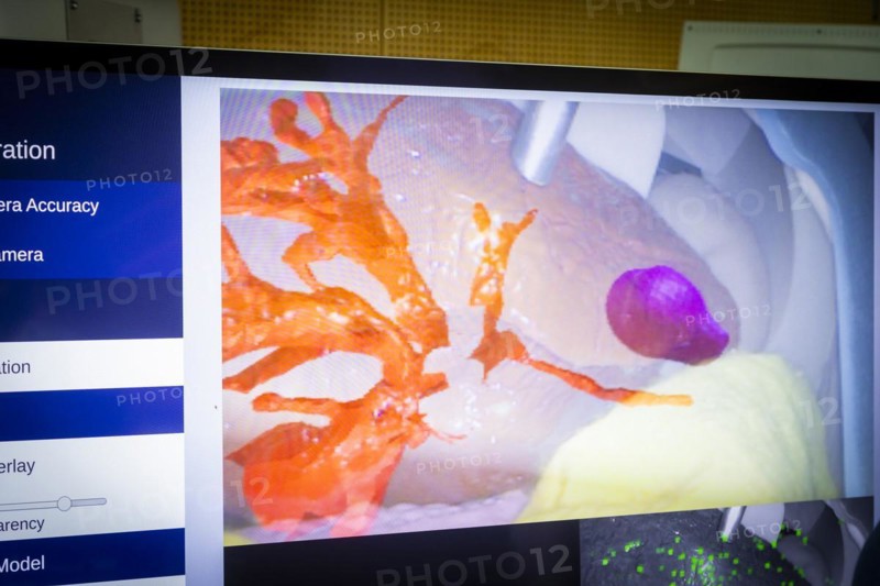 Clinical AI Day at the Dresden University Hospital, Dresden, Saxony, Germany, Europe