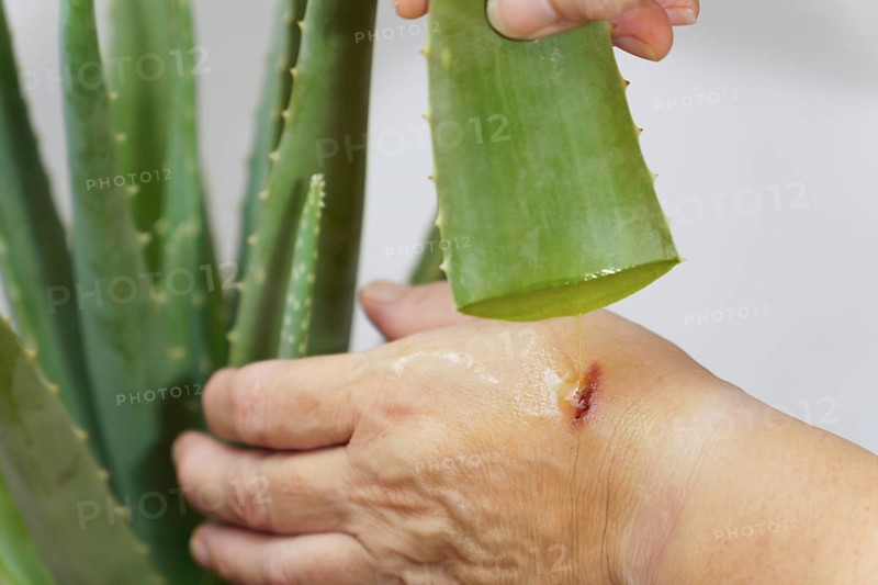 Close-up of a woman applying fresh aloe vera to a wound on her hand