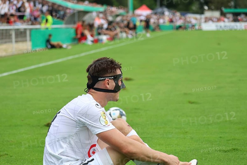 Tim Zölle (FC 08 Villingen) with face mask during the match for the DFB Cup 2022-23, 1st round: DFB Cup 2024-25, 1st main round: FC 08 Villingen, 1. FC Heidenheim 1846