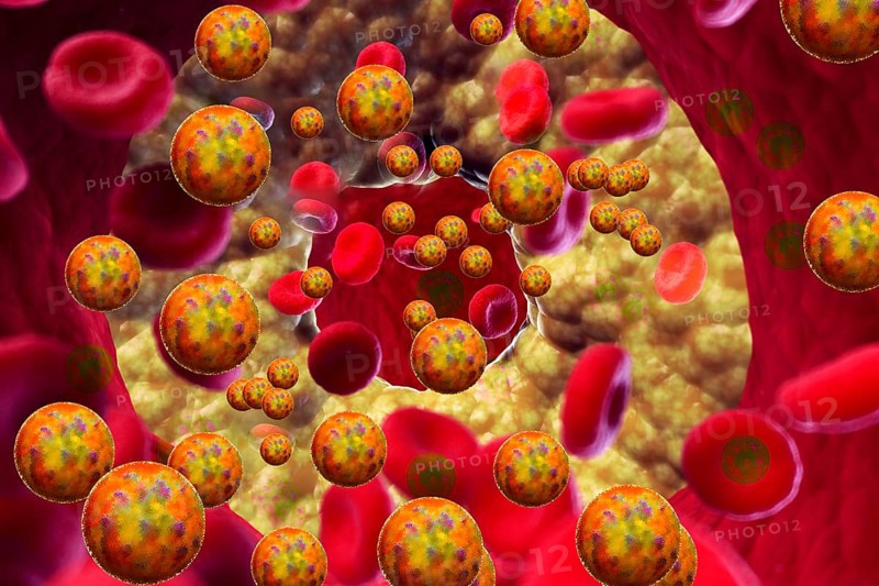 Cholesterol is an important raw material for the human body: it is needed for the formation of certain hormones and is a building block of the cell membrane