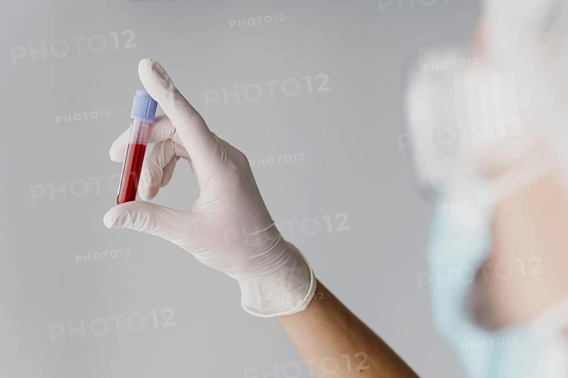 Back view doctor holding blood sample. Resolution and high quality beautiful photo