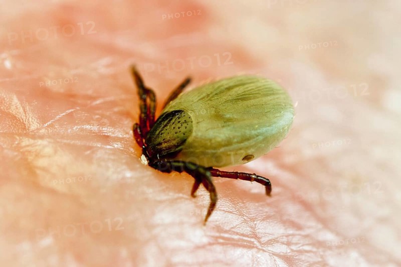 Tick bitten into human skin, common Castor Bean Tick (Ixodes ricinus), tick bite