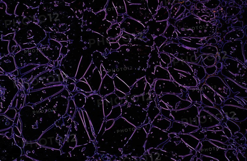 Lightning bolts radiatingas a background texture