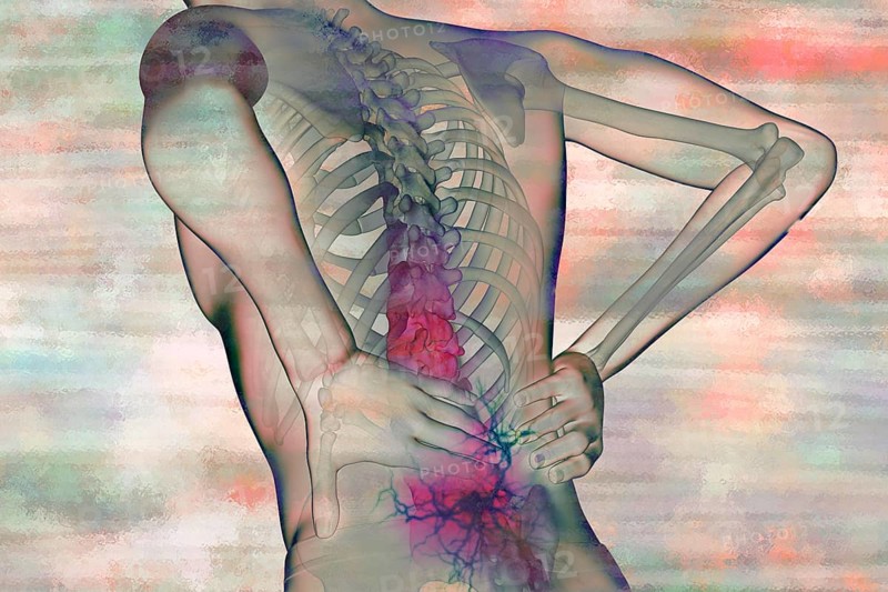 Back pain is a common condition and is particularly caused by sedentary behaviour