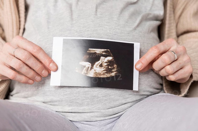 Close up pregnant woman with ultrasound image