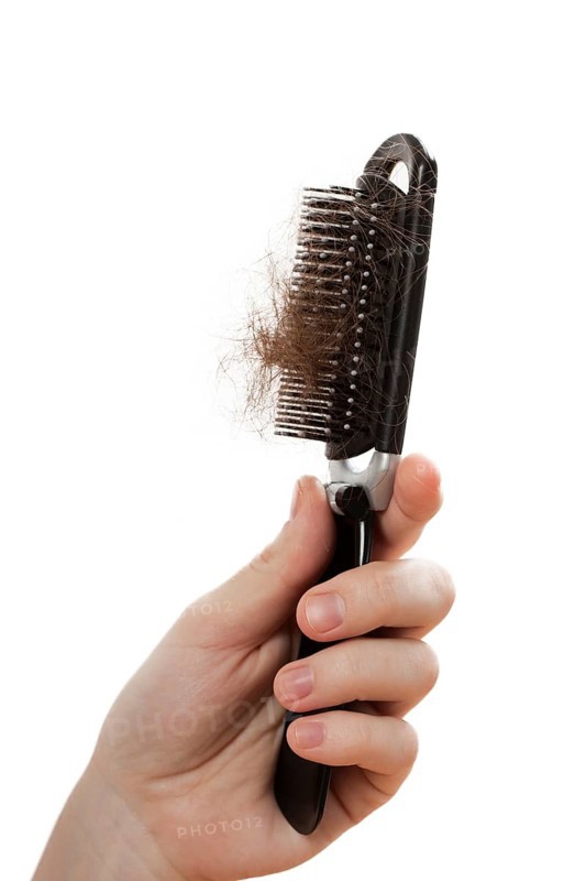 Balding problem women hand holding loss hair comb