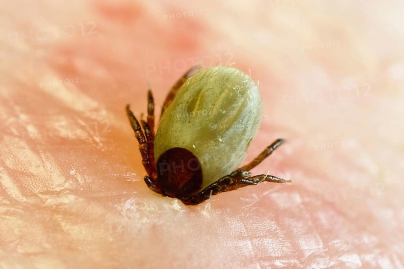 Tick bitten into human skin, common Castor Bean Tick (Ixodes ricinus), tick bite