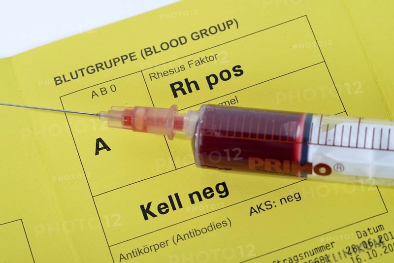 Blood group card, blood group passport, blood group, blood collection, blood sample, blood test, blood, A, rhesus positive, rhesus factor
