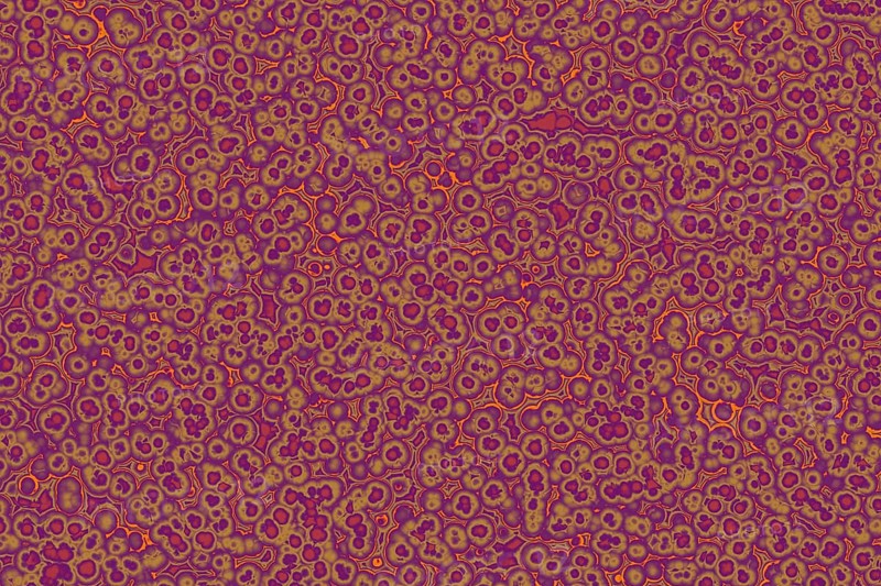 Shape of bacterial cell: cocci, bacilli, spirilla bacteria background