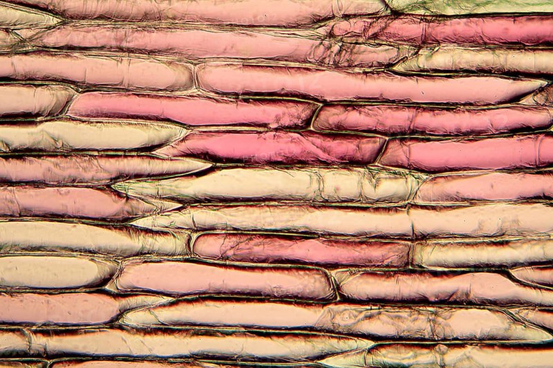 Onion cells under the microscope