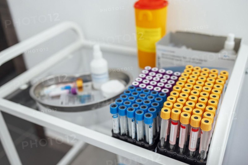 Blood test tubes on the glass table in clinic. Close up