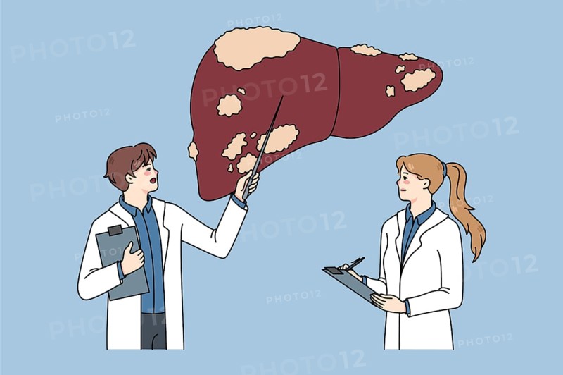 Diverse doctors in medical uniforms examine sick patient liver. Therapist make ultrasound body organ examinations. Hepatology therapy and healthcare. Flat illustration