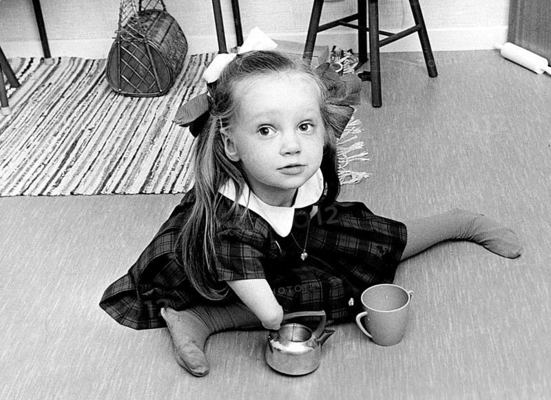 Thalidomide scandal. In the late 1950s and early 1960s, the use of thalidomide in 46 countries by women who were pregnant or who subsequently became pregnant, resulted in the biggest man-made medical disaster ever, resulting in more than 10, 000 children born with a range of severe deformities, such as phocomelia, as well as thousands of miscarriages. Thalidomide was introduced in 1956 and was aggressively marketed by the German pharmaceutical company Chemie Grünenthal under the trade name Contergan as a medication for anxiety, trouble sleeping, tension, and morning sickness. It was introduced as a sedative and medication for morning sickness without having been tested on pregnant women. While initially deemed to be safe in pregnancy, concerns regarding birth defects were noted in 1961, and the medication was removed from the market in Europe that year. 1966