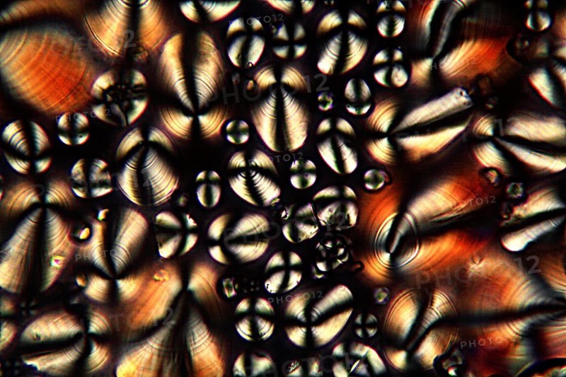 Potato starch under the microscope and in polarised light