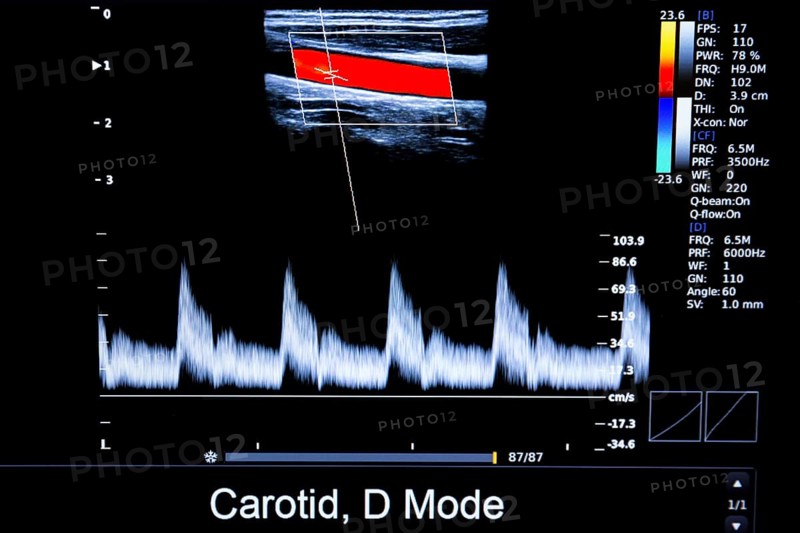 Colourful image of modern ultrasound monitor. Ultrasonography machine. High technology medical and healthcare equipment. Ultrasound imaging or sonography used in medicine. Human heart. Carodit