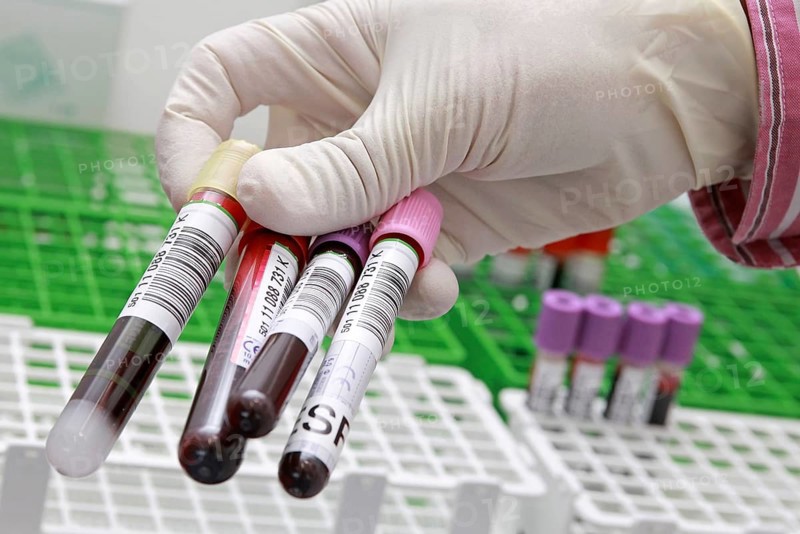 Blood donation