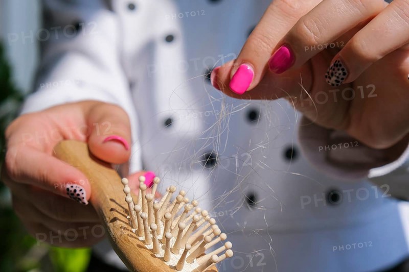 Hair loss on the comb, massage wooden brush with a clump of hair, problem of growth, hair care problems. Hair loss it cause from family history, hormonal changes, unhealthy of aging