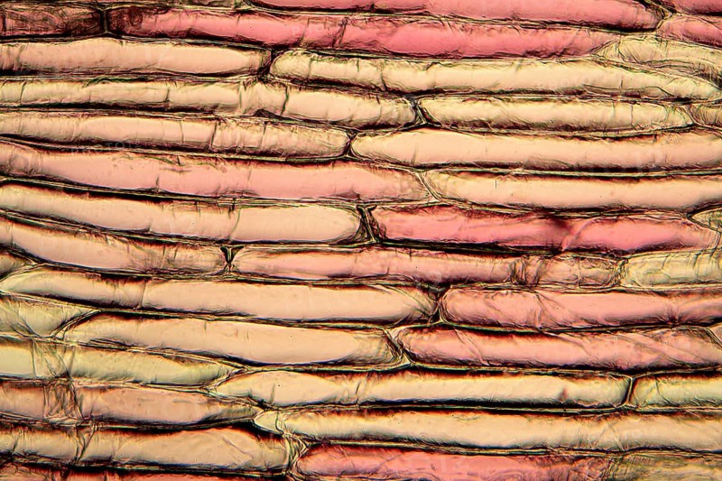 Onion cells under the microscope