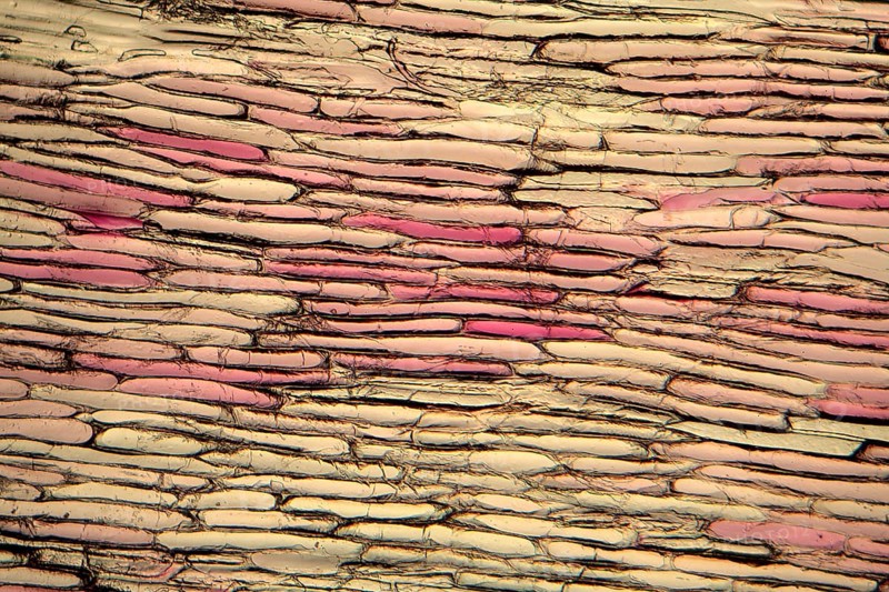 Onion cells under the microscope