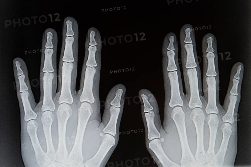 X-ray from human hands