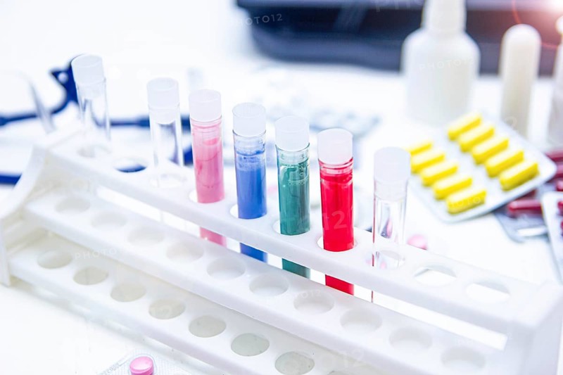 Colorful test tubes and medicine on a bright laboratory table