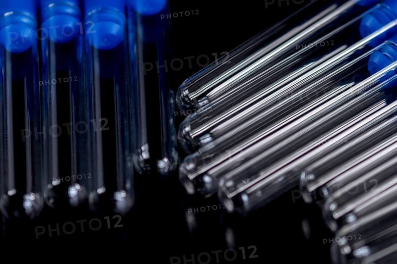 Laboratory Test Tubes on Black Background