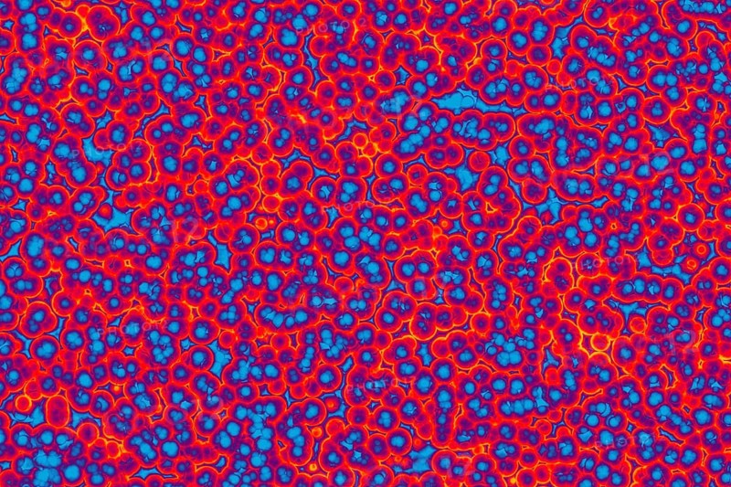 Shape of bacterial cell: cocci, bacilli, spirilla bacteria background