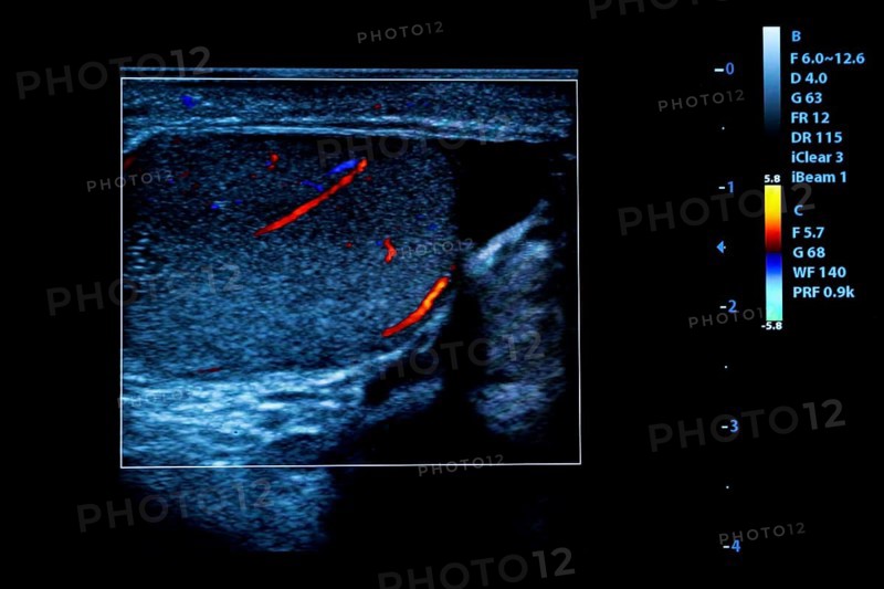 Colourful image of modern ultrasound monitor. Ultrasonography machine. High technology medical and healthcare equipment. Ultrasound imaging or sonography used in medicine