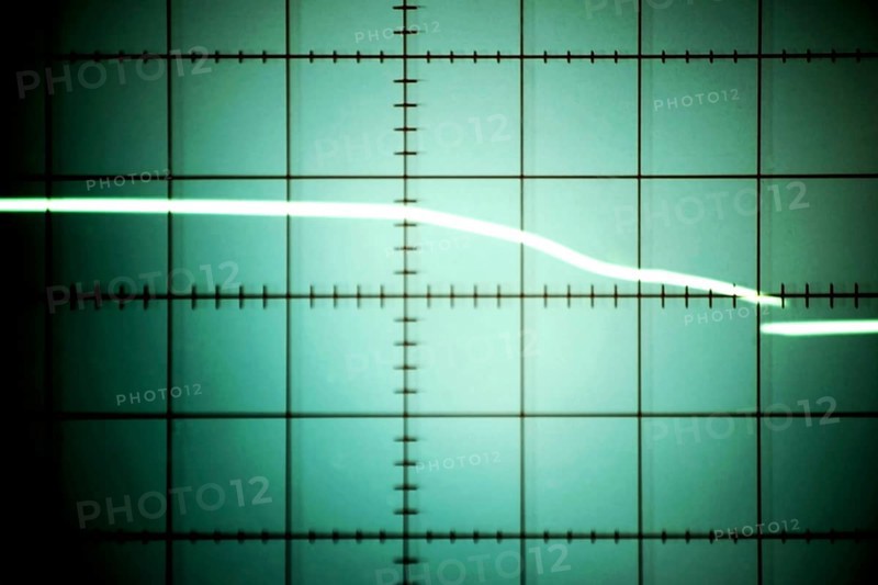 Asystole of the heart, a cardiac arrest and a zero line displayed on an oscilloscope