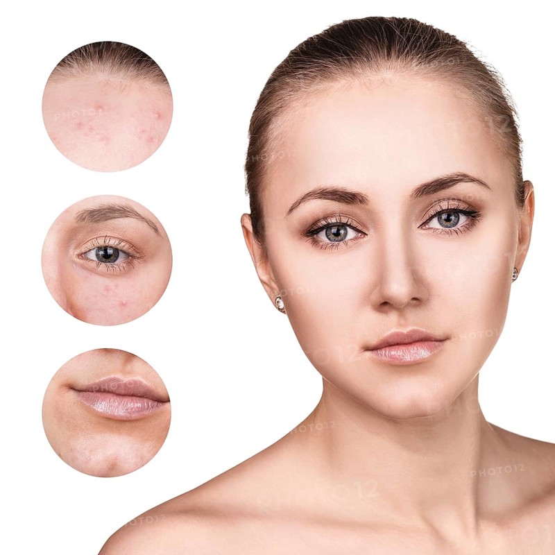Portrait of young woman and circles shows problem skin over white background