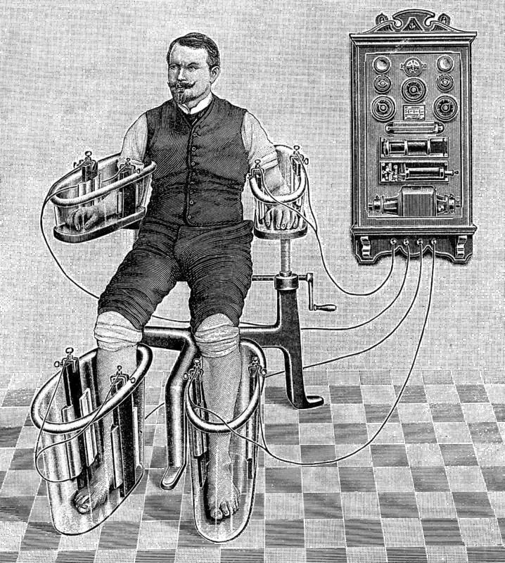 An illustration of a patient being treated with a four cell Schnee Bath, an early electric medical equipment for treating rheumatism