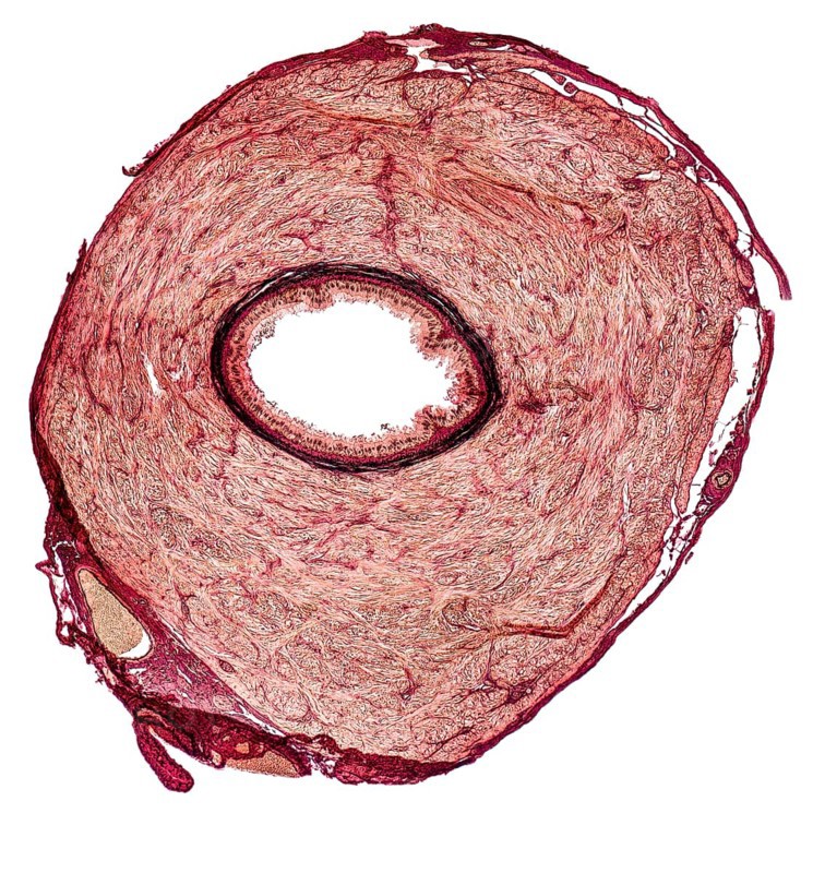 Microscopic cross section showing the vas deferens of a rat