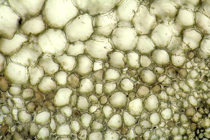 Full frame micrography showing the cell structure of a Bryophyllum plant