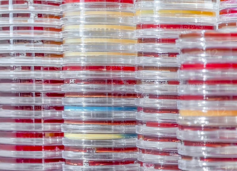 Full frame abstract shot showing lots of stacked petri dishes filled with colorful agar growth medium