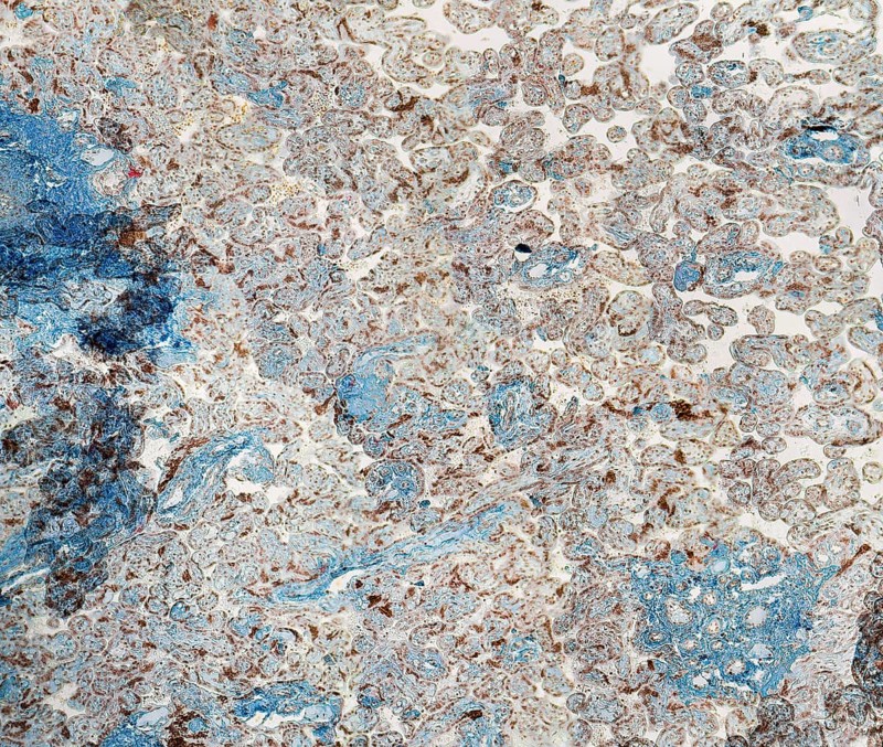 Stained full frame human placenta micrography
