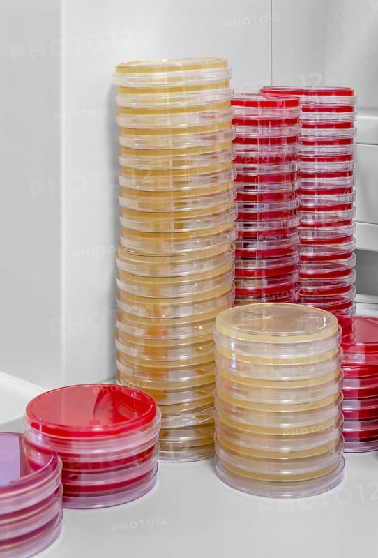 Lots of stacked petri dishes filled with colorful agar growth medium