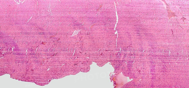 Microscopic detail showing a rats heart detail