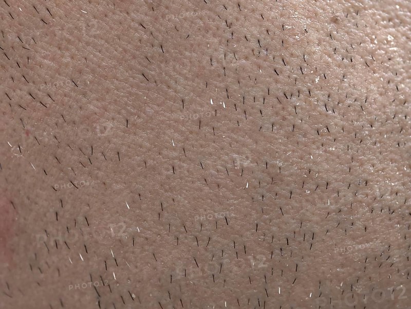 The skin of man's face with stubble and flaky skin, sparse gray hairs in the beard, Karaganda, Kazakhstan
