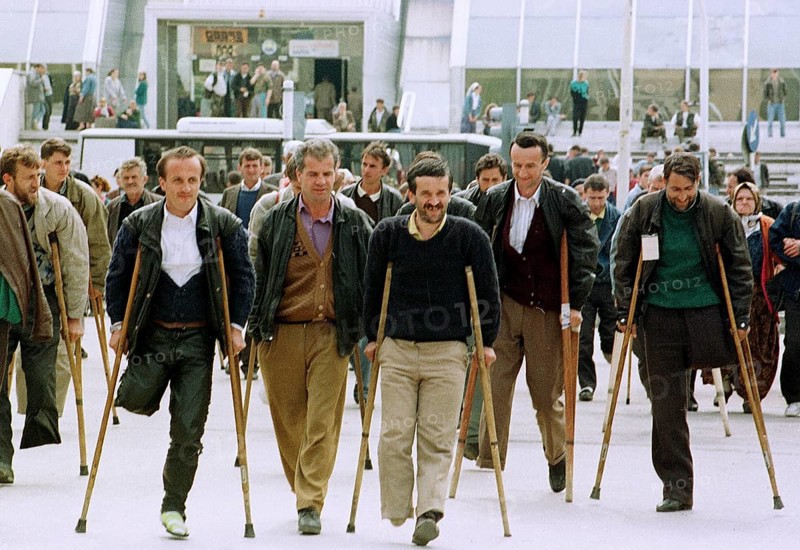 BIH, Tuzla, 01.05.1993 -- Refugees from Srebrenica on their way to prosthesis testing in Tuzla. -- Refugees from Srebrenica on their way for further treatment in Tuzla.   Bosnia Hercogovina, Eastern Europe