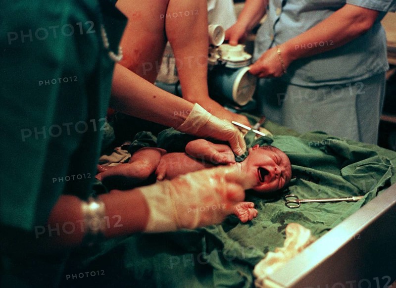 Sarajevo, BIH, 01.08.1995 -- series of 10 pictures - Maternity hospital during the civil war in 1995, newborn baby being washed.   Bosnia Hercogovina, Eastern Europe